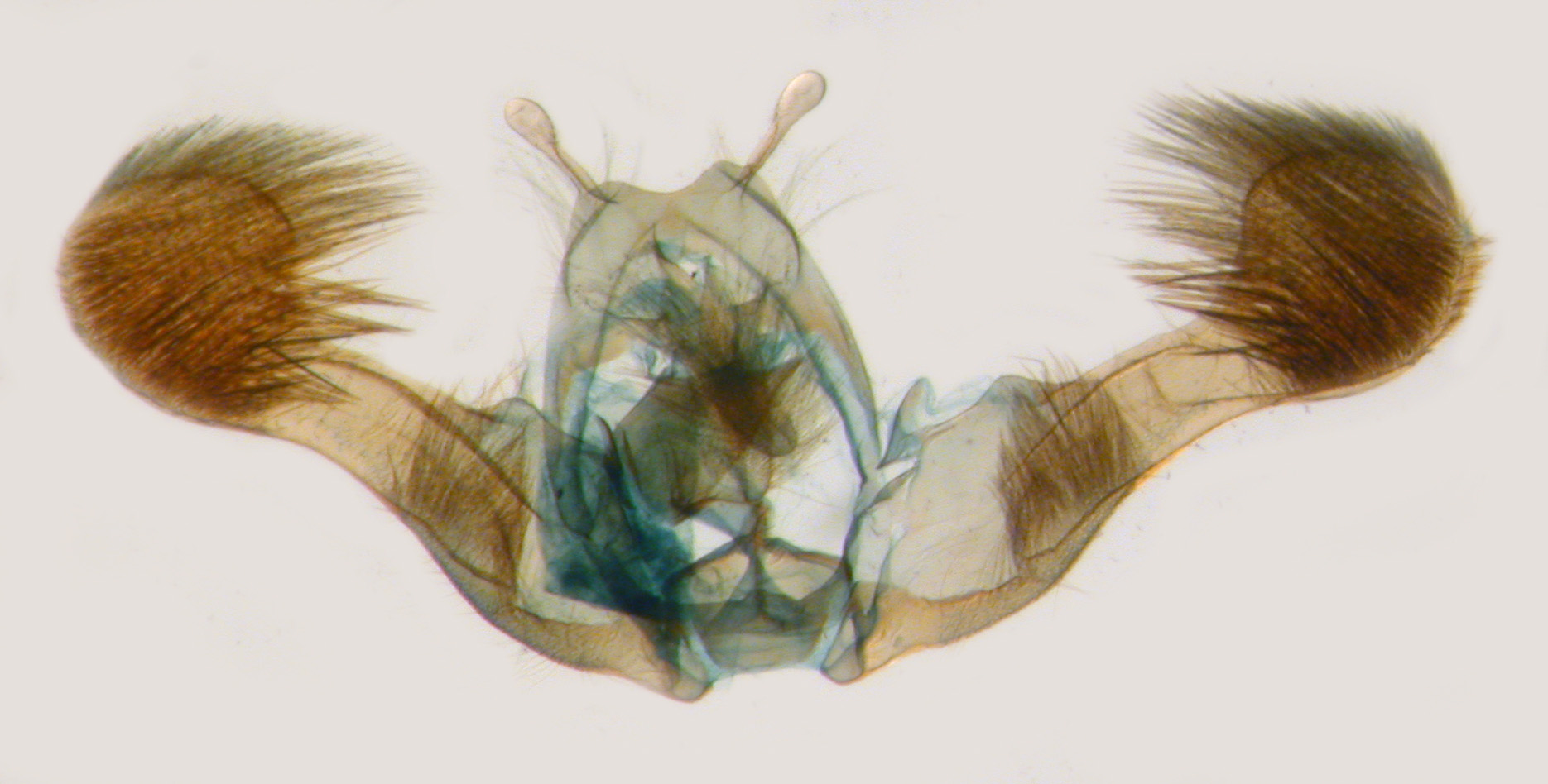 Rhopobota genitalia